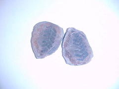 Fern Fossils