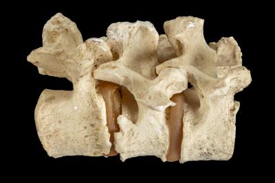 Vertebrae Cast