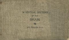 Book, '36 Vertical Sections Of The Brain' by Dr. W.M. Fuller