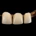 Bridge Work, False Teeth