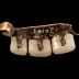 Bridge Work, False Teeth