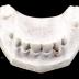 Model, Plaster Of (uppers)