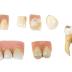 Tools, Dental Kit, Also Dental In Wooden Box