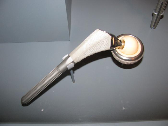 Artificial Hip