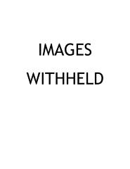 Photograph, Hazel Green Mound Profile and Artifacts